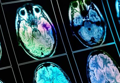 Symptomy, terapia i konsekwencje toksoplazmozy