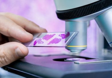 Interpretacja wyników cytologicznych w skali Papanicolau i systemie Bethesda