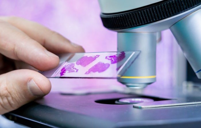 Interpretacja wyników cytologicznych w skali Papanicolau i systemie Bethesda